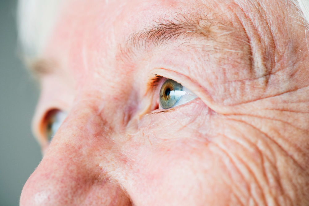 Glaucoma pode aposentar